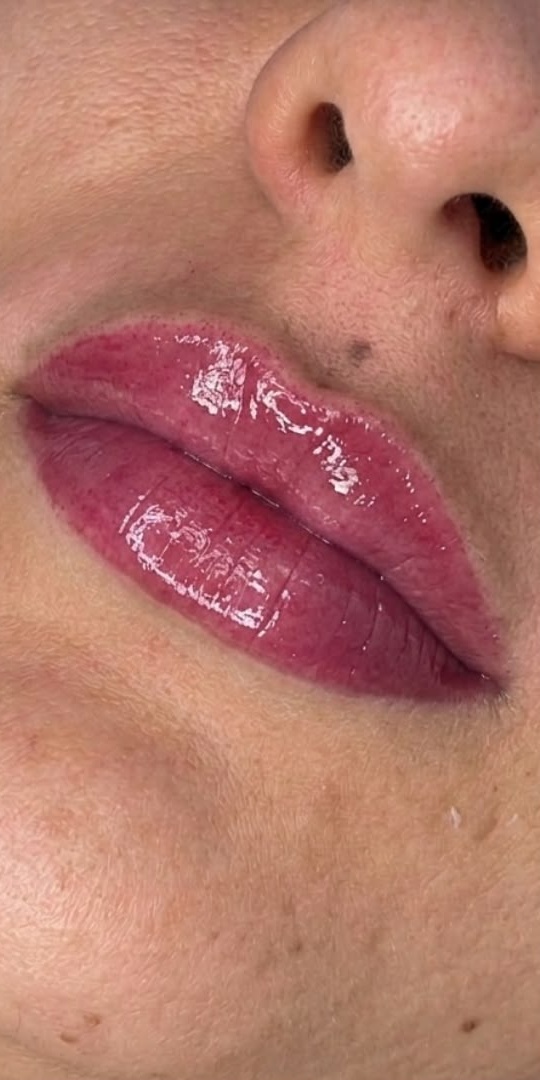 Depois — lábios com cor e brilho após Micropigmentação Labial