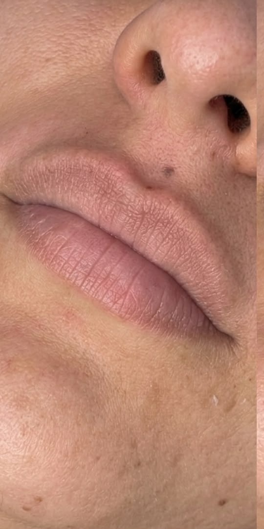 Antes — lábios naturais antes da Micropigmentação Labial