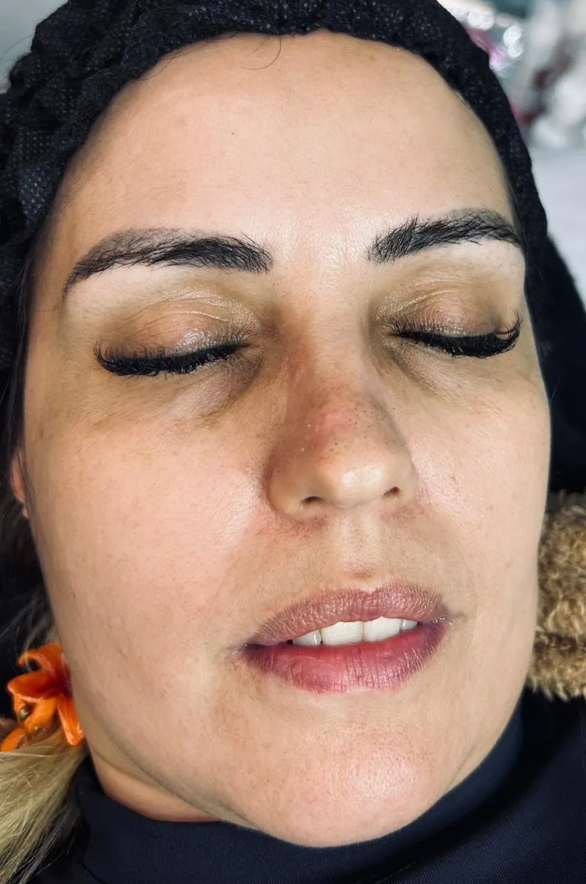 Antes — sobrancelhas antes do Dermaplaning