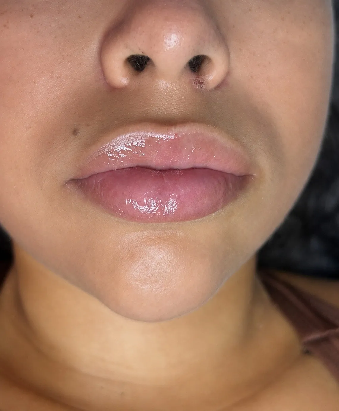 Depois — lábios hidratados e com brilho após Hydra Gloss