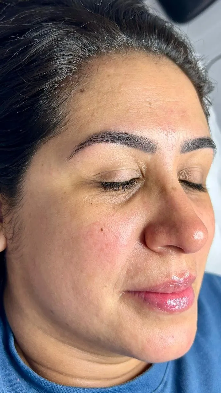 Depois — pele limpa, revitalizada e iluminada após limpeza de pele